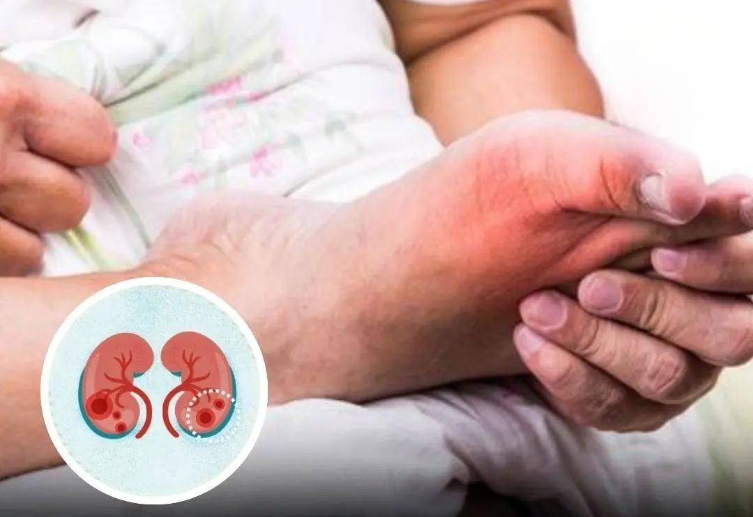 5 Odd Foot Symptoms That May Be Your Kid.neys’ Silent SOS