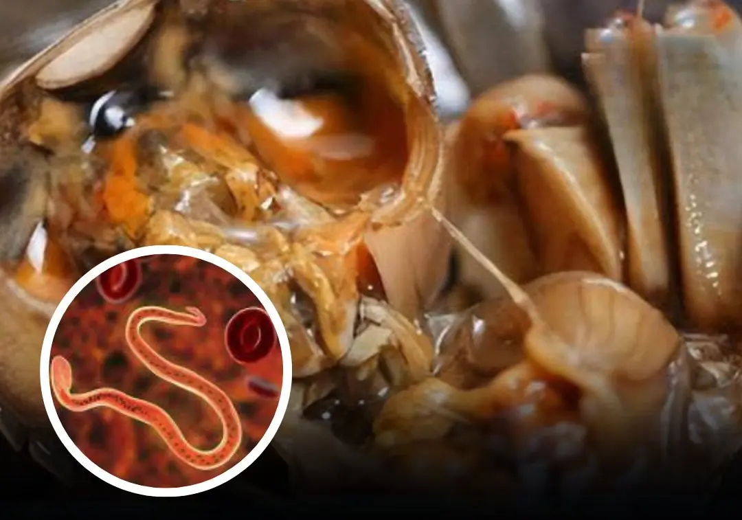 Sh:ocking Doctor’s Warning: You Might Be Eating Parasites in These 4 Common Foods