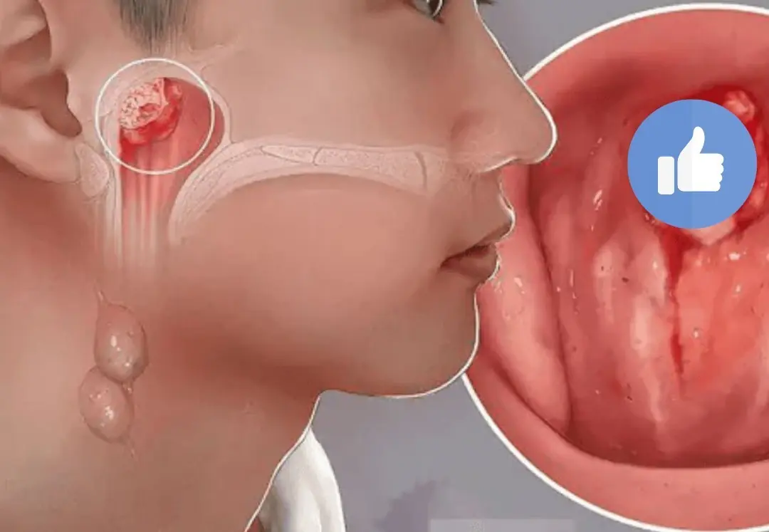 5 nose-related warning signs that may point to underlying dis.ea.ses