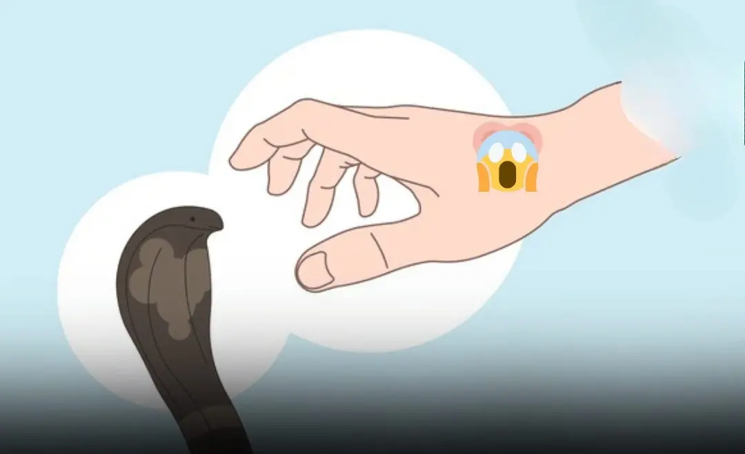 The First Steps to Take After a Snake Bi:te