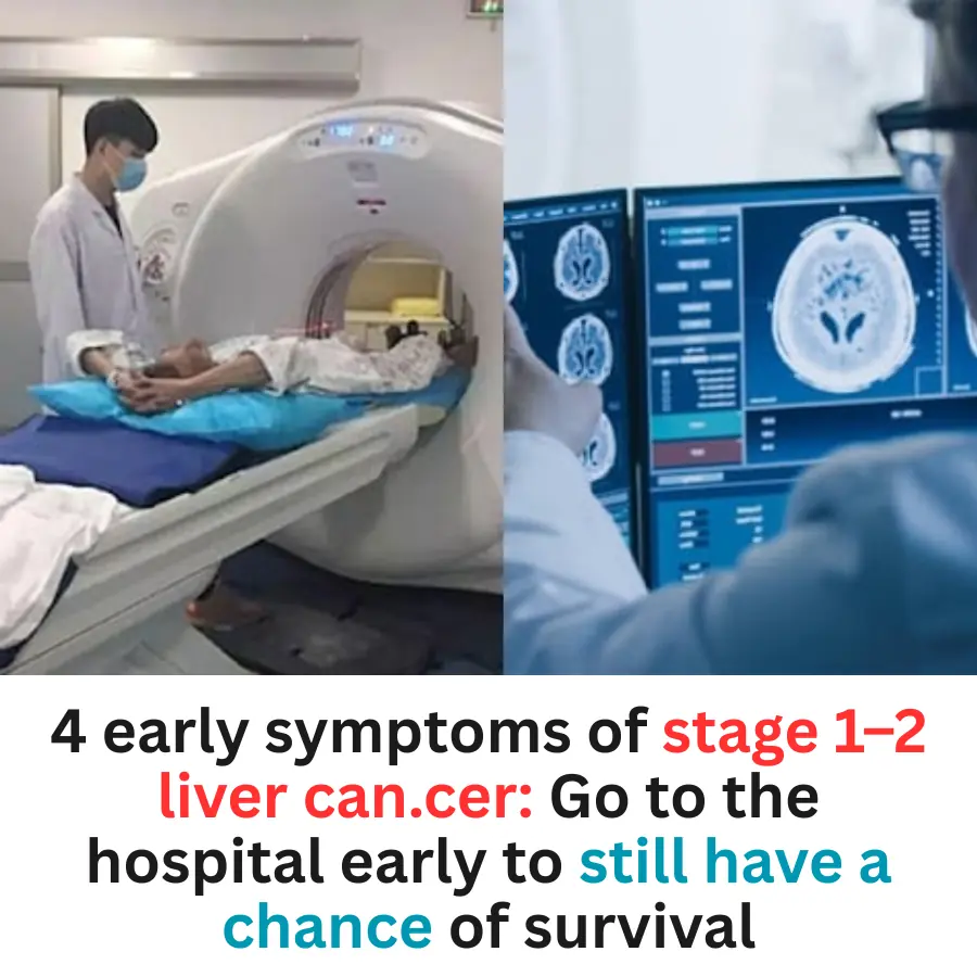 4 Early Symptoms of Stage 1–2 Liver Can.cer: Early Detection Can Save Lives