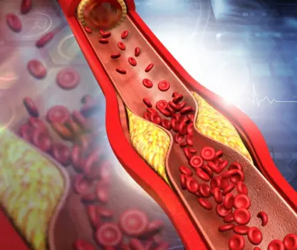 The daily drink that helps clear blocked arteries naturally