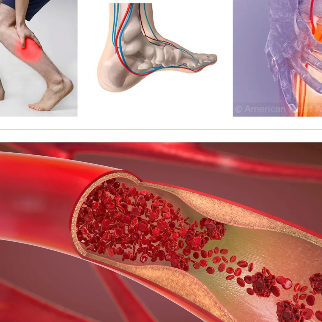 Not many people know the warning signs of a he.art block.age that appear in your feet and legs at night