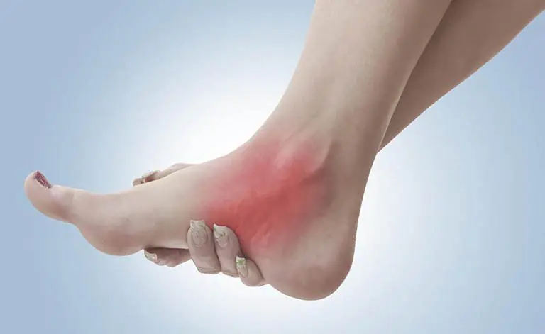 People with gout should strictly avoid the following foods