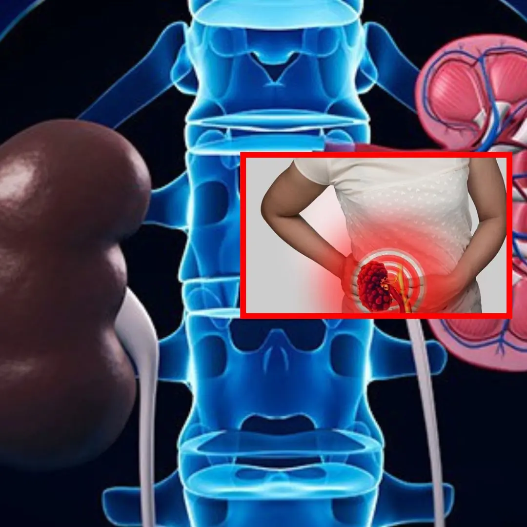 7 indicators that your kidneys are functioning well - check