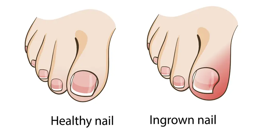 If you have these 6 signs on your feet, you should see a doctor soon because your health is having serious problems