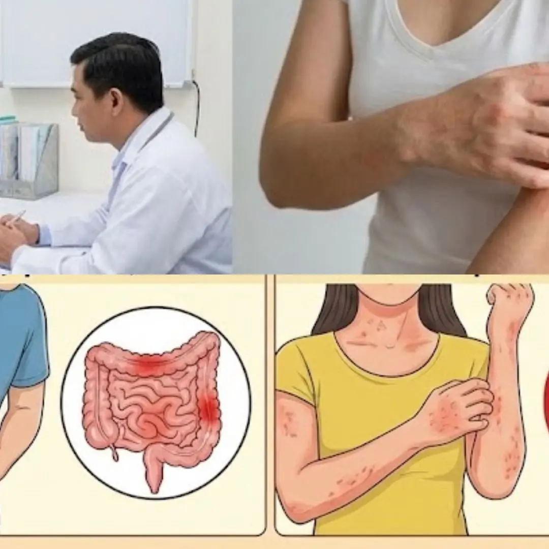 Not Everyone Should Eat Onions: Here’s Who Needs to Be Careful