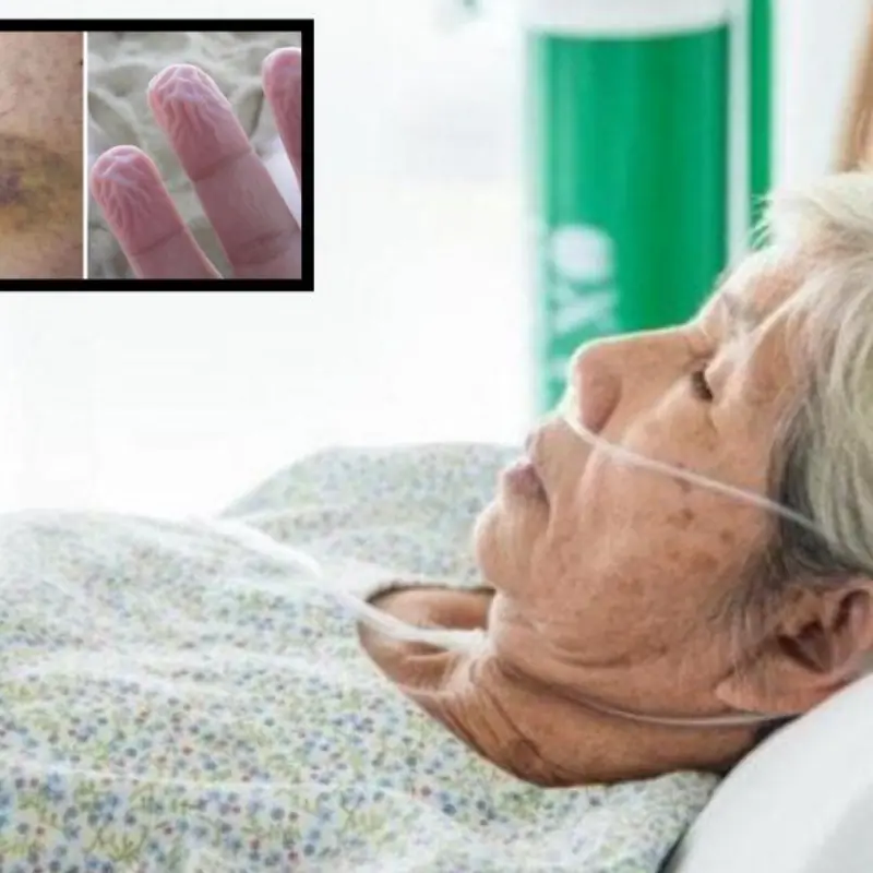 “One Year Before Death”? Doctors Say These 6 Signs May Signal Serious Health Decline