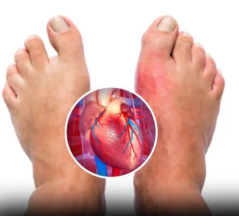 One Month Before A Heart Attack, Your Body Will Warn You Of These 7 Signs