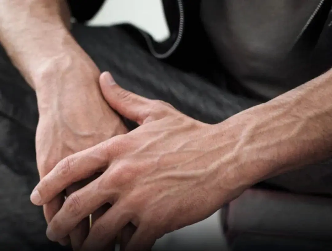 If you notice someone with bulging v.e.i.n.s, these are the crucial things you need to tell them