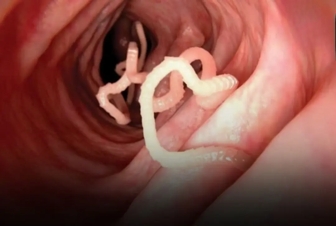 The first sign is especially common in many households