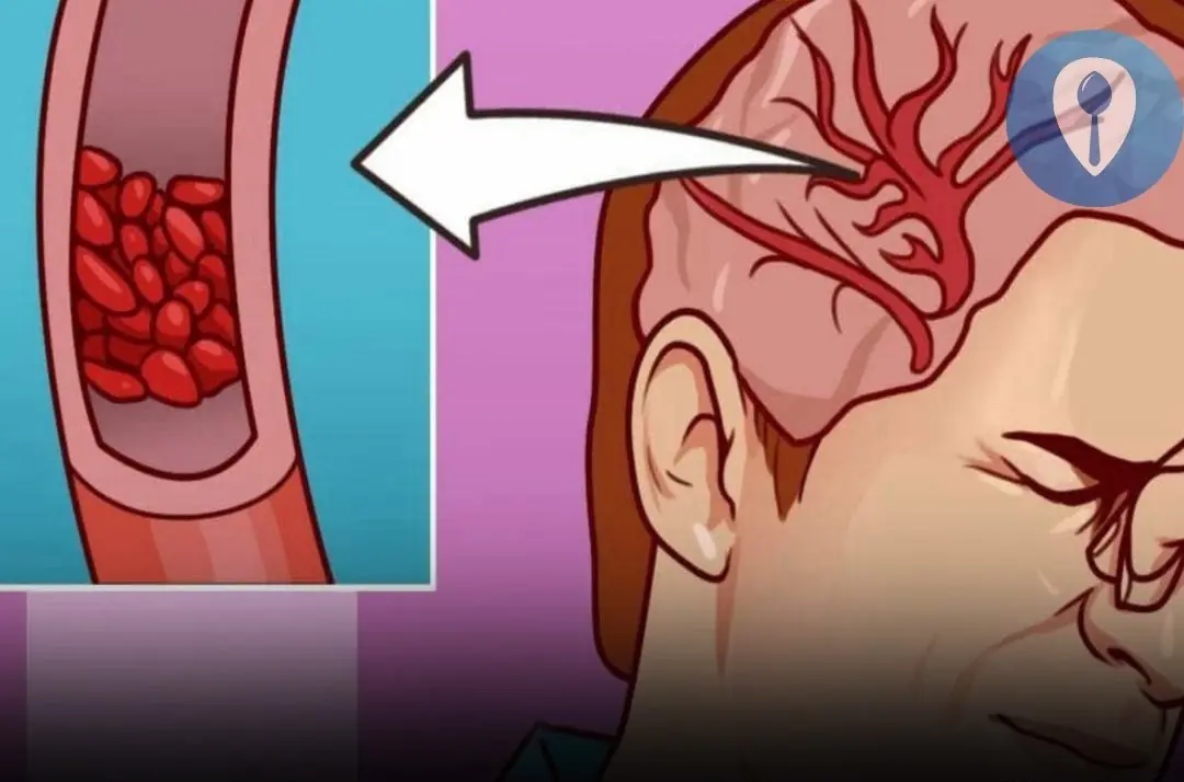 I experience 6 of these