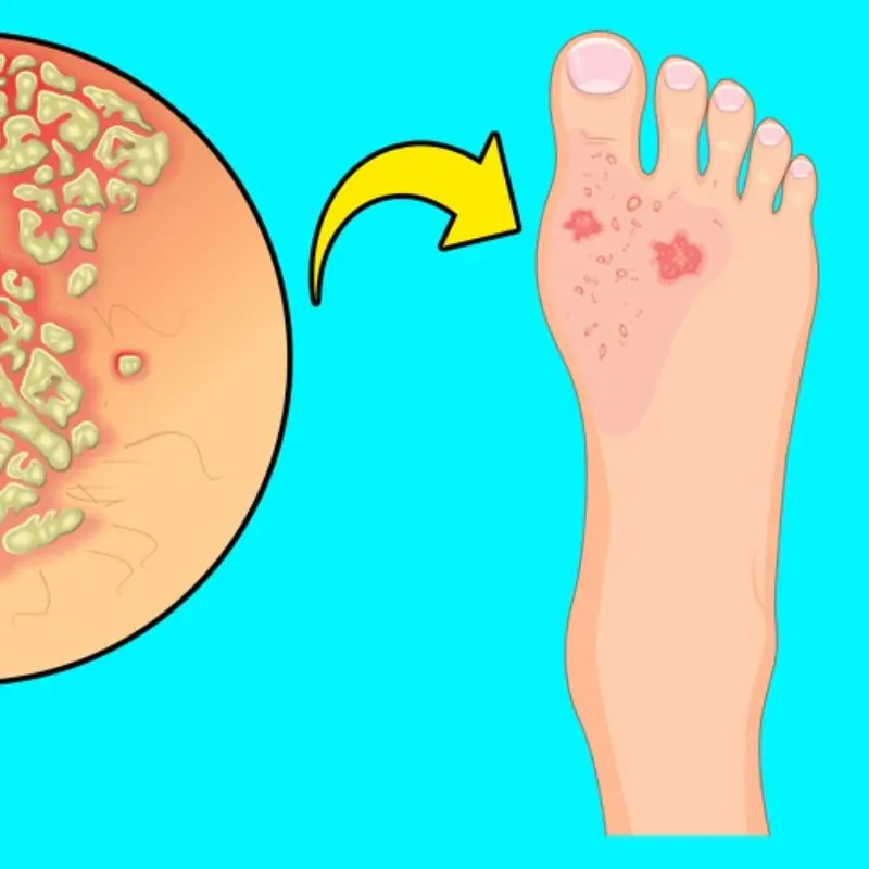 6 warning signs in your feet that may signal serious health problems, see a doctor early.