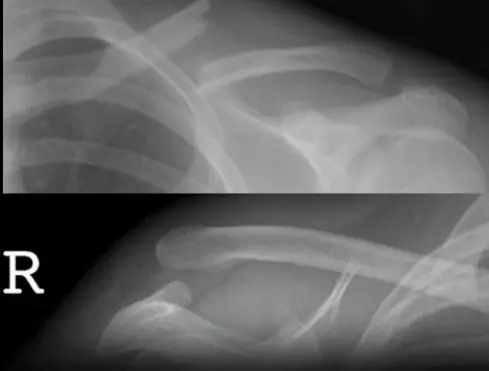 This Drink Will Destroy Your Bones From The Inside But Everyone Drinks It Anyway