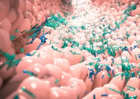 Twin Study Reveals Gut Microbiome's Role in Multiple Sclerosis Development