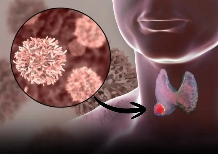 7 early warning signs of nasopharyngeal can.cer
