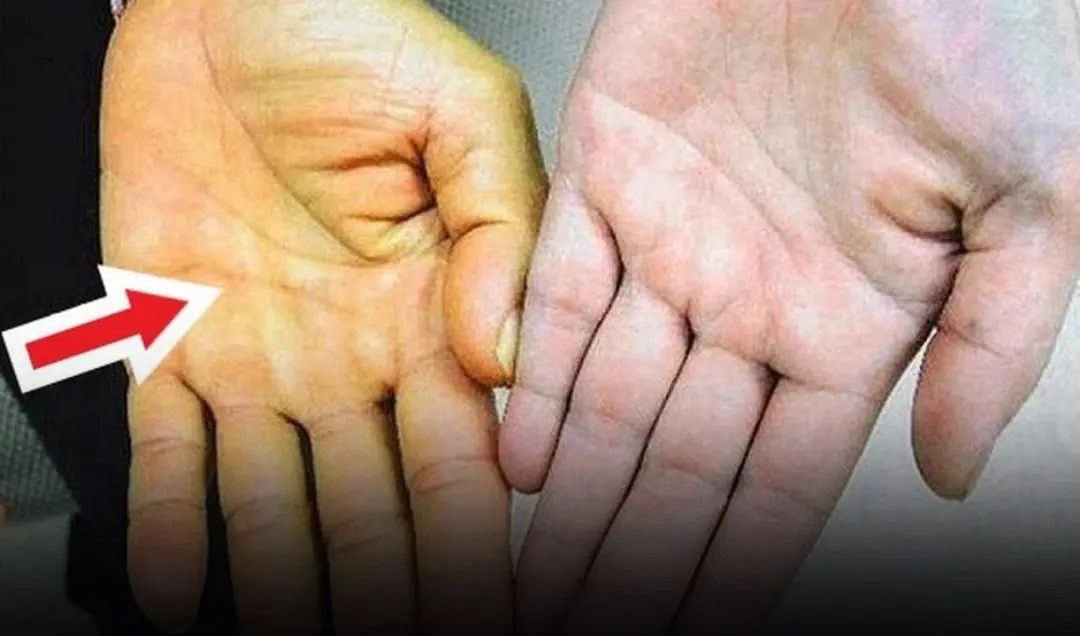 Before Cancer Is Diagnosed, Hands and Feet May Show These 4 Warning Changes