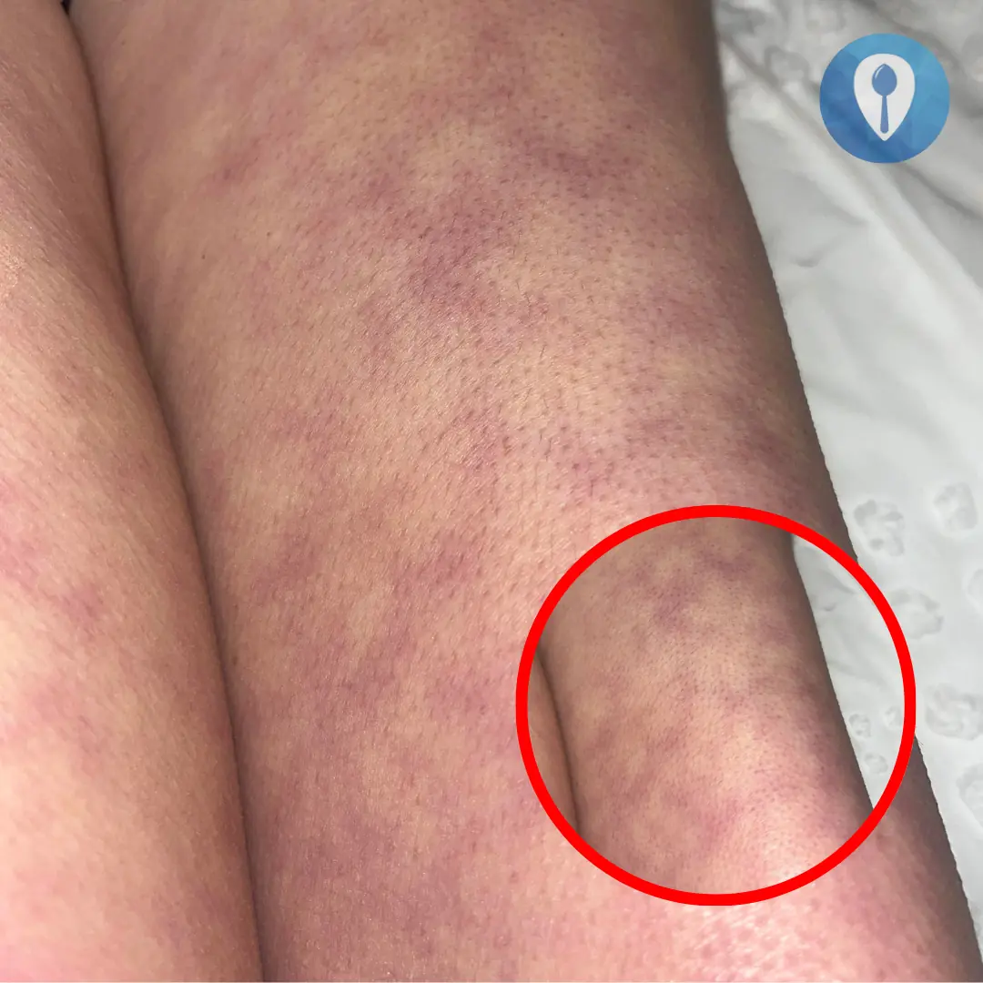 You won’t believe the consequences of sleeping with… 👀