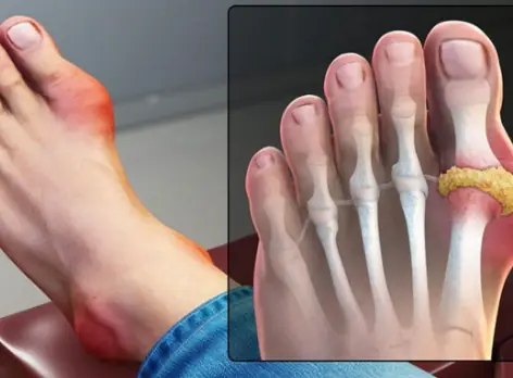 6 Physical Changes That Happen When Your Heart is In Serious Danger