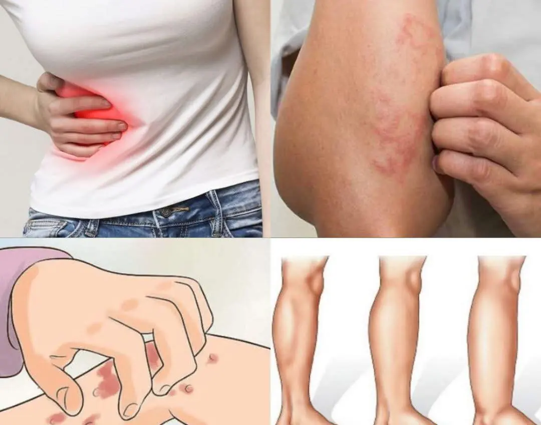 🩺 If Your Kidneys Are in Danger, Your Body Will Warn You With These 8 Signs