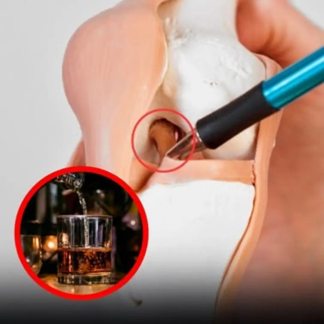 6 foods that silently drain calcium from the body, the more you eat, the weaker your bones become