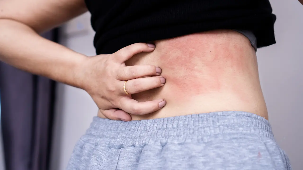 Two itchy body parts may signal liver can.cer - Many people mistakenly think it is an allergy