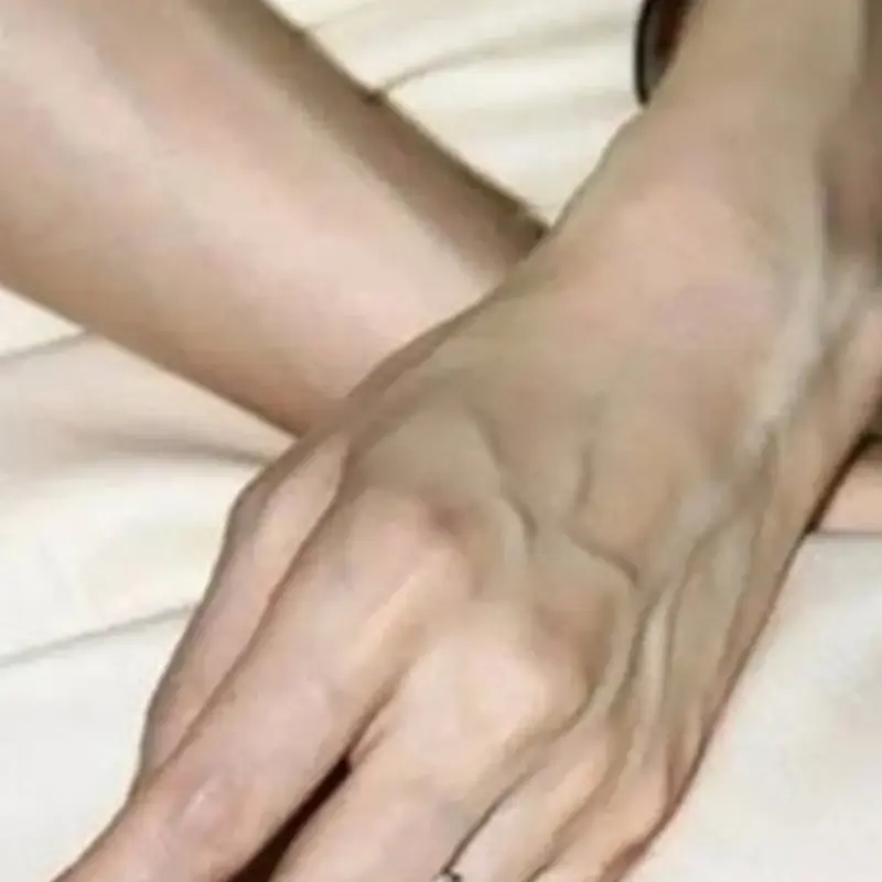 If someone has prominent veins, share these important tips