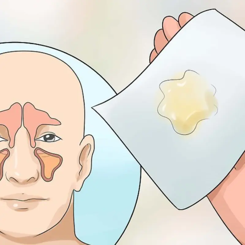 Common Reasons You Get Mucus in Your Throat