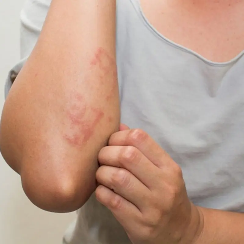 8 kid.ney failure warning signs you should never ignore.