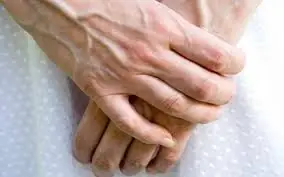 Warn them as soon as possible