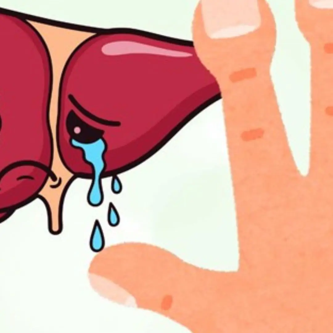 People with liver failure often have 3 characteristics on their hands, if you have 1 you should see a doctor soon