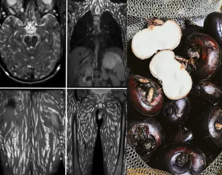 Eating Just One Bite is Already Harmful, But Many Still Eat It Without Worry