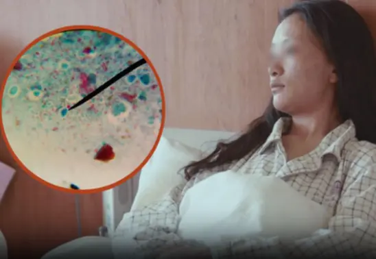 24-Year-Old Woman Suffers Stomach Perforation Due to One Common Morning Coffee Mistake