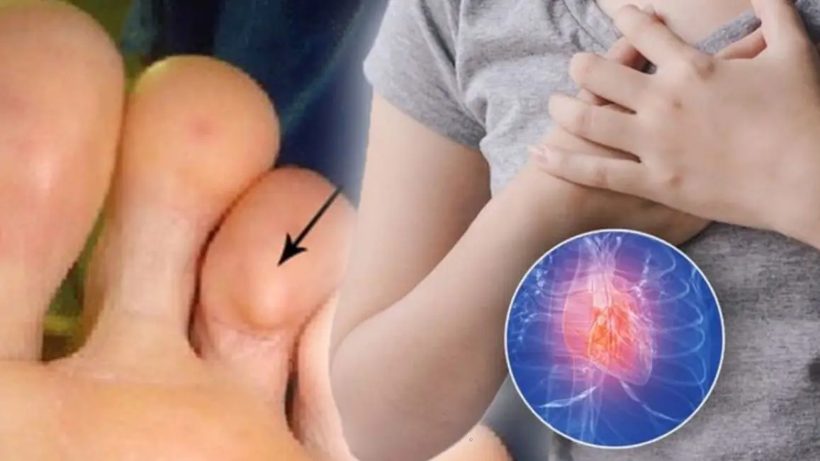 Up to 3 months before a heart att.ack, the body often sends out 5 critical warning signs but many people ignore them