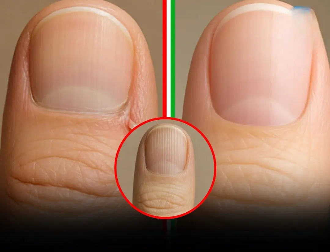 5 Silent Health Problems Your Nails Reveal Before Anything Else 👇