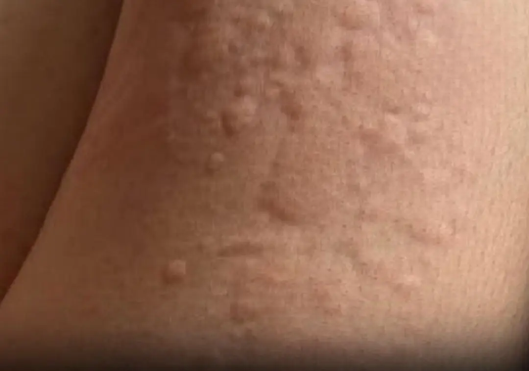 What he thought was a simple allergy turned out to be something far more alarming when doctors gave their diagnosis