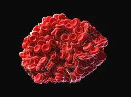 Não ignore estes 7 sintomas matinais - eles podem estar ligados ao câncer