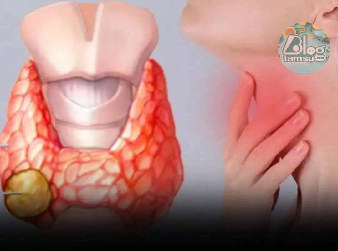 Your Thyroid Is Begging You to Stop Eating These 6 Foods Immediately!