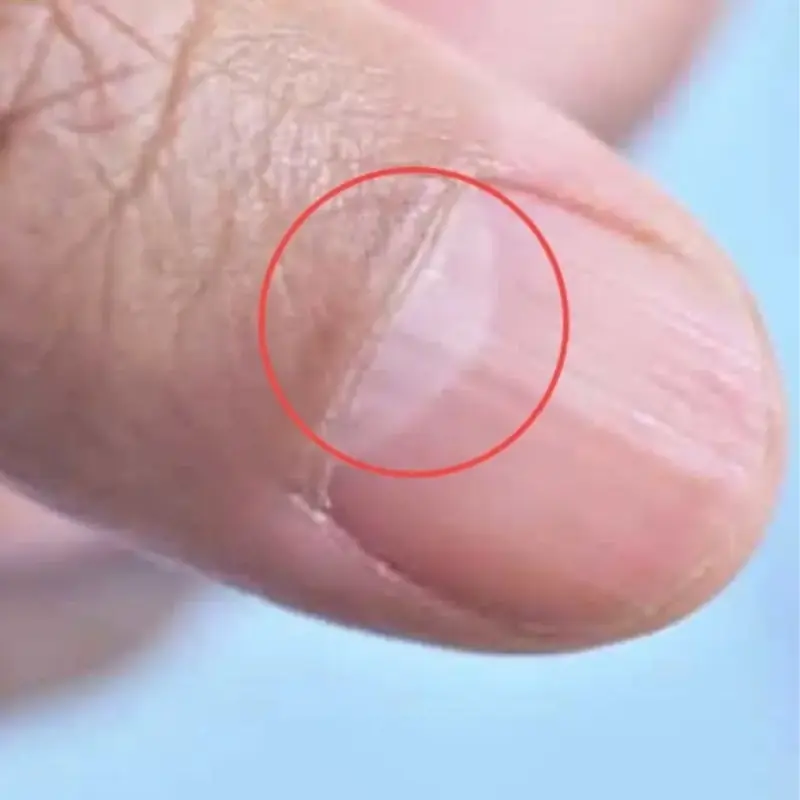 Don’t Throw Away Rice Water — Why This “Kitchen Waste” Is Surprisingly Useful Around the House