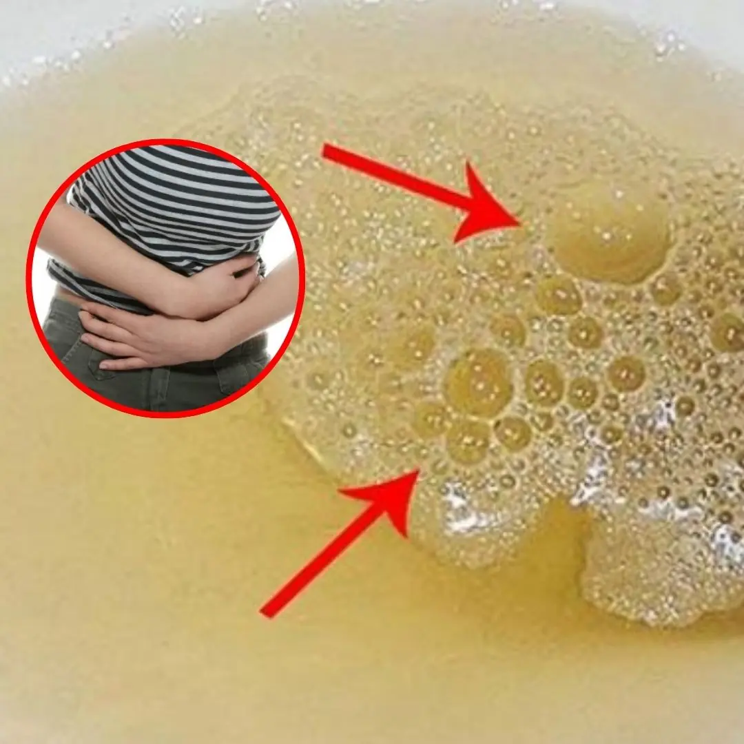 Men and women who see these 3 signs in their urine need to see a doctor for kidney failure immediately