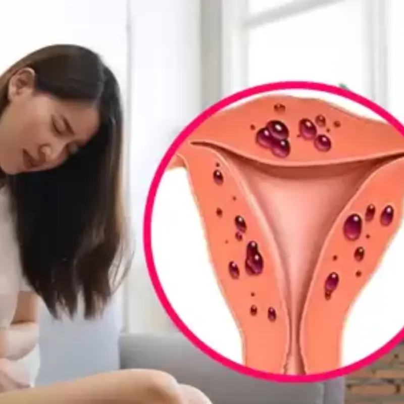 5 early signs of cer.vical can.cer many women ignore.