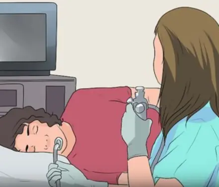 Colonoscopy: The key question you should ask your doctor before the procedure