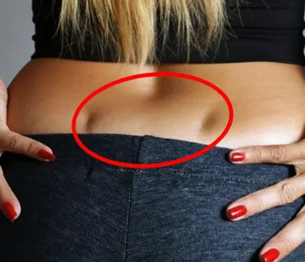 If You Have These Two "Dimples" on Your Lower Back, Here's What They Mean