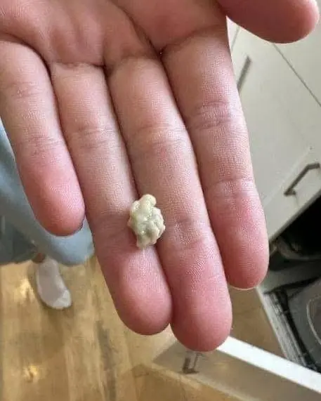 Today, my throat feels completely clear — right after this little thing came out.  What was it?