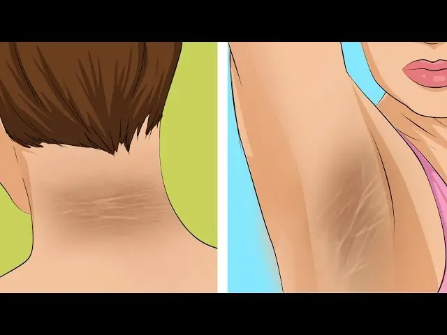 If you notice these 10 symptoms this morning, don't ignore them - you might have diabetes without realizing it