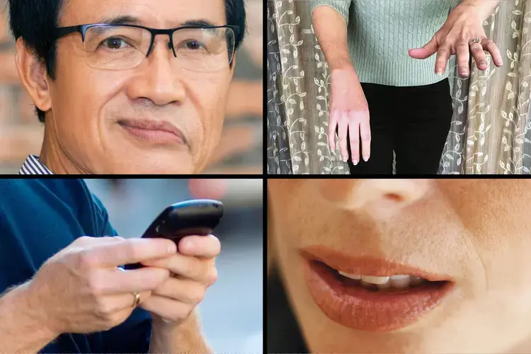 A Stroke Doesn’t Give You a Second Chance: 6 Things You Must Do — and 3 De.adly Mistakes to Avoid