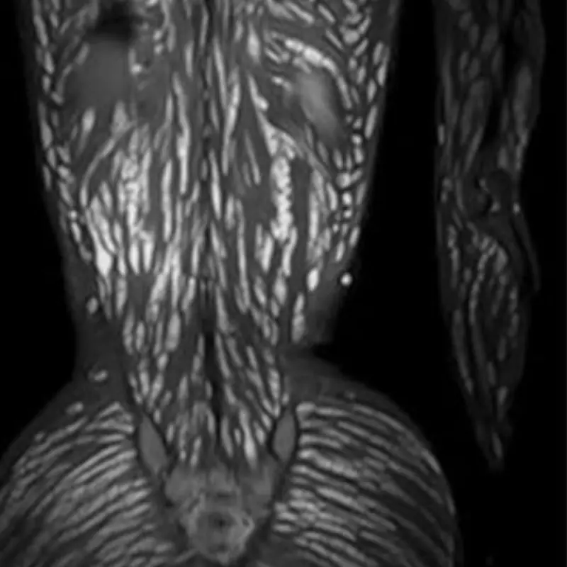 Don’t take it lightly: a single bite may bring thousands of para.sites into your system.