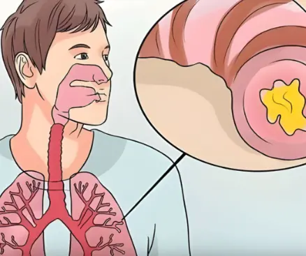 Get Rid of Throat Mucus Faster With These Home Treatments (Evidence Based)