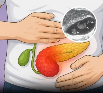The Most Likely Symptoms of a Gallbladder Problem (Don’t Ignore Them)
