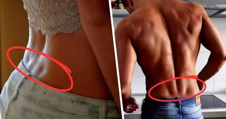 If you have these two small dimples on your lower back, they reveal something fascinating... Keep reading